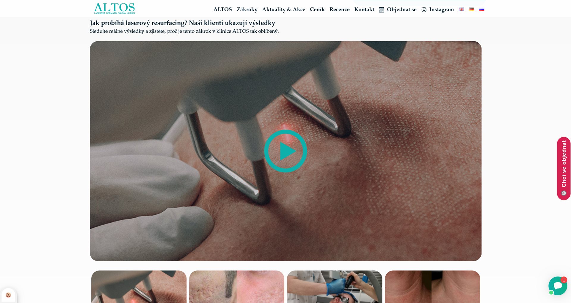screenshot-2024-12-09-at-09-39-57-laserovy-resurfacing-frakcnim-co-laserem-laserova-dermatologicka-klinika-altos-praha-2 screenshot-2024-12-09-at-09-39-57-laserovy-resurfacing-frakcnim-co-laserem-laserova-dermatologicka-klinika-altos-praha-2